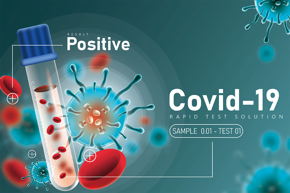 acerca de SARS-CoV-2 (COVID-19) pruebas